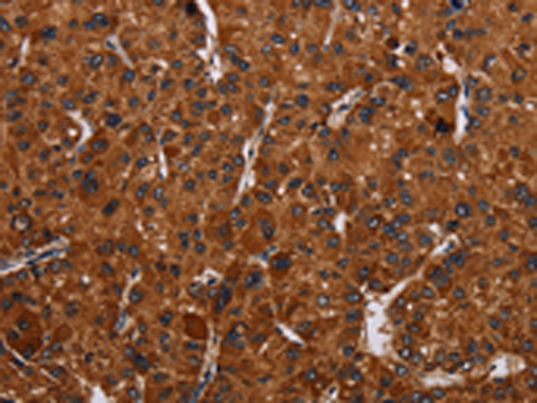 Rabbit Polyclonal Antibody to RTN4R
