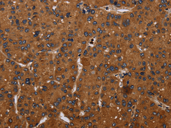 Rabbit Polyclonal Antibody to CYBB