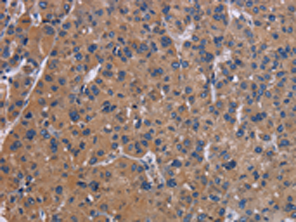 Rabbit Polyclonal Antibody to NPC1