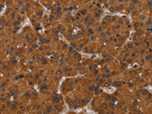 Rabbit Polyclonal Antibody to NPHS2