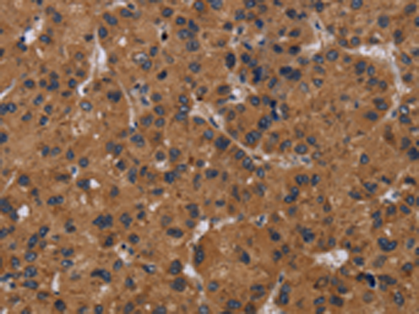 Rabbit Polyclonal Antibody to NPRL2