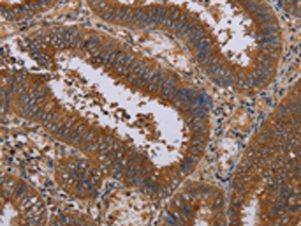 Rabbit Polyclonal Antibody to NPTX1