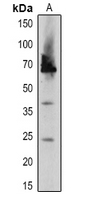 Rabbit Polyclonal Antibody to DEGP2