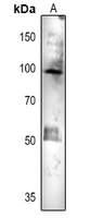 Rabbit Polyclonal Antibody to ACO1