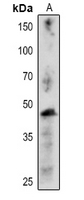 Rabbit Polyclonal Antibody to CFBP1
