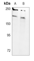 Rabbit Monoclonal Antibody to SMCHD1