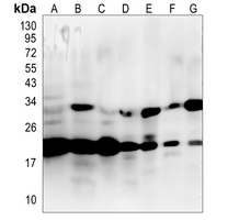 Rabbit Monoclonal Antibody to AKAP14