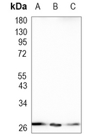 Rabbit Monoclonal Antibody to GTF2F2