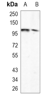 Rabbit Monoclonal Antibody to ARHGAP26
