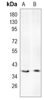 Rabbit Monoclonal Antibody to LOR
