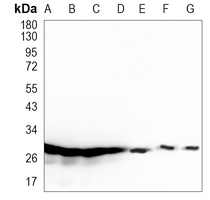 Rabbit Monoclonal Antibody to SNRPA1