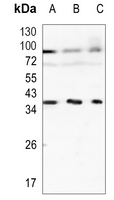 Rabbit Monoclonal Antibody to KLRG1