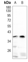 Rabbit Monoclonal Antibody to RGMA