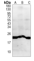 Rabbit Monoclonal Antibody to WFDC2