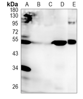 Rabbit Monoclonal Antibody to VSX2