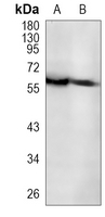 Rabbit Monoclonal Antibody to TUB