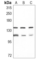 Rabbit Monoclonal Antibody to PHF8
