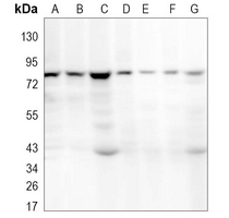 Rabbit Monoclonal Antibody to ALDH16A1