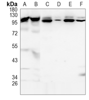 Rabbit Monoclonal Antibody to TNPO3