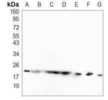 Rabbit Monoclonal Antibody to SRP19