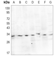 Rabbit Monoclonal Antibody to RYBP