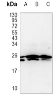 Rabbit Monoclonal Antibody to MRPS15