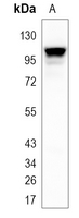 Rabbit Monoclonal Antibody to TFR2
