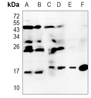 Rabbit Monoclonal Antibody to PFDN5