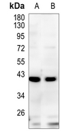 Rabbit Monoclonal Antibody to TMOD2