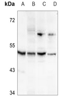 Rabbit Polyclonal Antibody to ALDH3B2