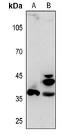Rabbit Polyclonal Antibody to APAF1