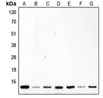 Rabbit Polyclonal Antibody to CDKN2A