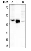 Rabbit Polyclonal Antibody to CPA1