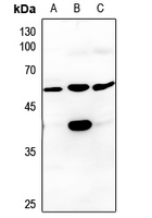 Rabbit Polyclonal Antibody to CSNK1G3