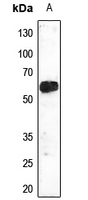 Rabbit Polyclonal Antibody to ETV6