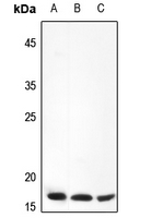 Rabbit Polyclonal Antibody to FOLR3