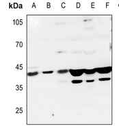 Rabbit Polyclonal Antibody to HTR1D