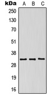 Rabbit Polyclonal Antibody to KIR2DS5