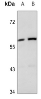 Rabbit Polyclonal Antibody to KRT84