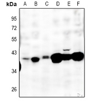 Rabbit Polyclonal Antibody to MT-ND2