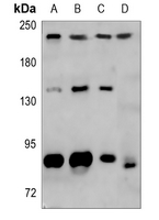Rabbit Polyclonal Antibody to MYH8