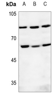 Rabbit Polyclonal Antibody to POLE2