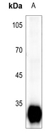 Rabbit Polyclonal Antibody to PRSS3