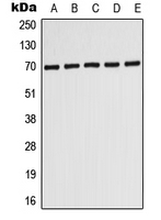 Rabbit Polyclonal Antibody to ABCD3