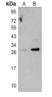 Rabbit Polyclonal Antibody to SGCB