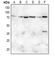 Rabbit Polyclonal Antibody to SLC5A2