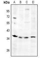Rabbit Polyclonal Antibody to TNFAIP6