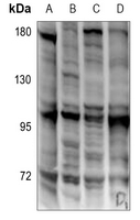 Rabbit Polyclonal Antibody to EOMES