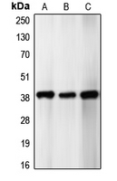 Rabbit Polyclonal Antibody to CDK5R2