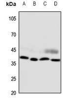 Rabbit Polyclonal Antibody to CCRL2